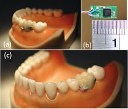 Oralsensor Oralsensor