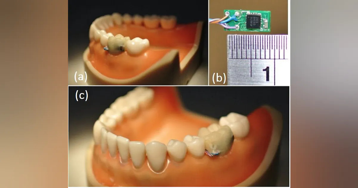 Researchers develop oral sensor to track eating, drinking habits ...