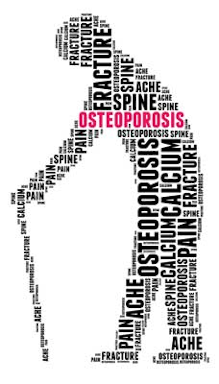 What does osteoporosis have to do with oral health? | DentistryIQ