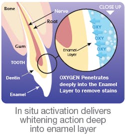 Pacdent Ibrite Es Pacdent Ibrite Es