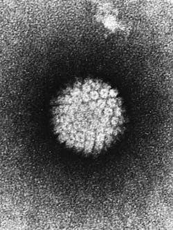 Papilloma Virus Hpv Em Papilloma Virus Hpv Em