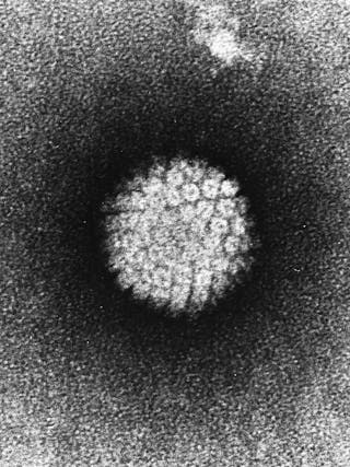 Papilloma Virus Hpv Em
