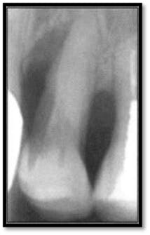 Pennwell web 214 335 Pennwell web 214 335