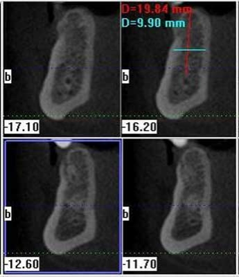 Pennwell web 345 400