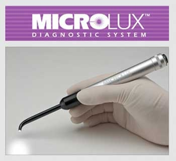 Caries detection Beyond explorers Dentistry IQ