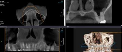 Pennwell web 400 173