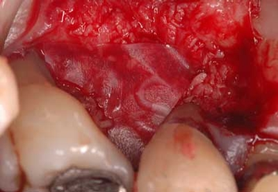 Pennwell web 400 277