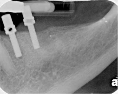 Pennwell web 400 320