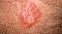 Pennwell web 425 236 Pennwell web 425 236