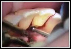 Placement Geristore 2 Placement Geristore 2