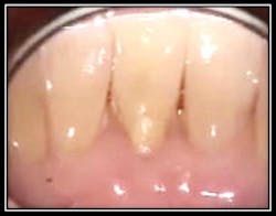 Post Geristore 4 Post Geristore 4