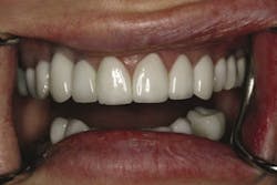 Pp 001 Opt Pp 001 Opt