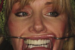 Pp Img 1452 Opt Pp Img 1452 Opt