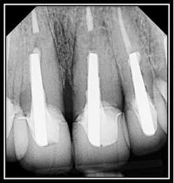 Preop Xray Fo Preop Xray Fo