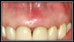 Pretreatment England Fo Pretreatment England Fo