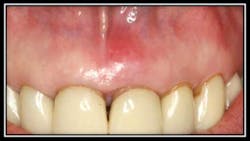 Pretreatment England Fo Pretreatment England Fo