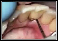 Probe Geristore 1 Probe Geristore 1