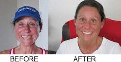 Prosthodontics Week Prosthodontics Week