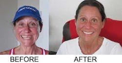 Prosthodontics Week Prosthodontics Week