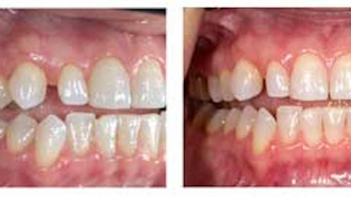 Ratcliffconvorthovsinvisalign