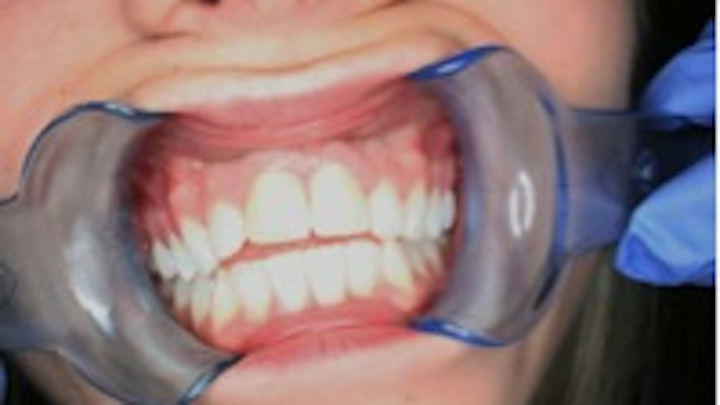 Rdhcasestudy1