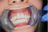 Rdhcasestudy1 Rdhcasestudy1