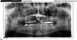 Rdhcasestudy4 Rdhcasestudy4