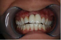 Rdhcasestudy7 Rdhcasestudy7
