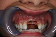 Rdhcasestudy9 Rdhcasestudy9