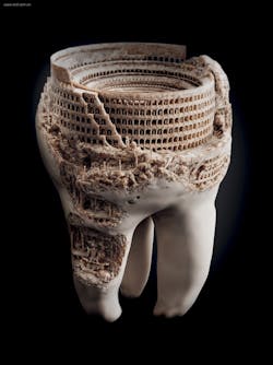 Romon Coliseum Tooth Romon Coliseum Tooth