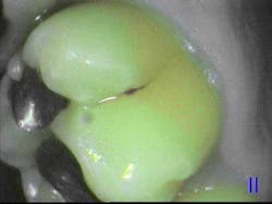 Salierno Soprolife May2014 Salierno Soprolife May2014