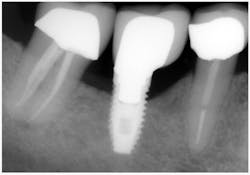 Sawyer Xray 3 Sawyer Xray 3