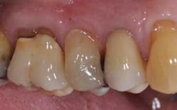 Sept2012marchack02 Sept2012marchack02