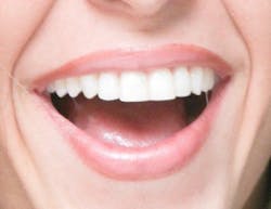 Shakira Smile Shakira Smile