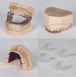 Sirona Ortho Es Sirona Ortho Es