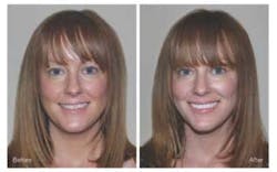 Smile Simplicity Smile Simplicity