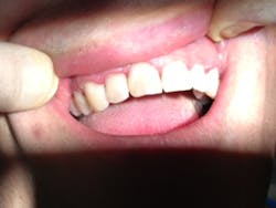 Soldierafter1 Soldierafter1