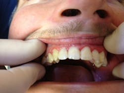 Soldierafter2 Soldierafter2