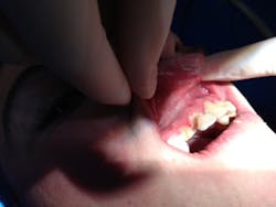 Soldierbefore1 Soldierbefore1