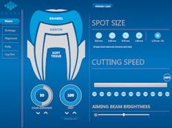 Solea Xc Spot Size Gui Solea Xc Spot Size Gui
