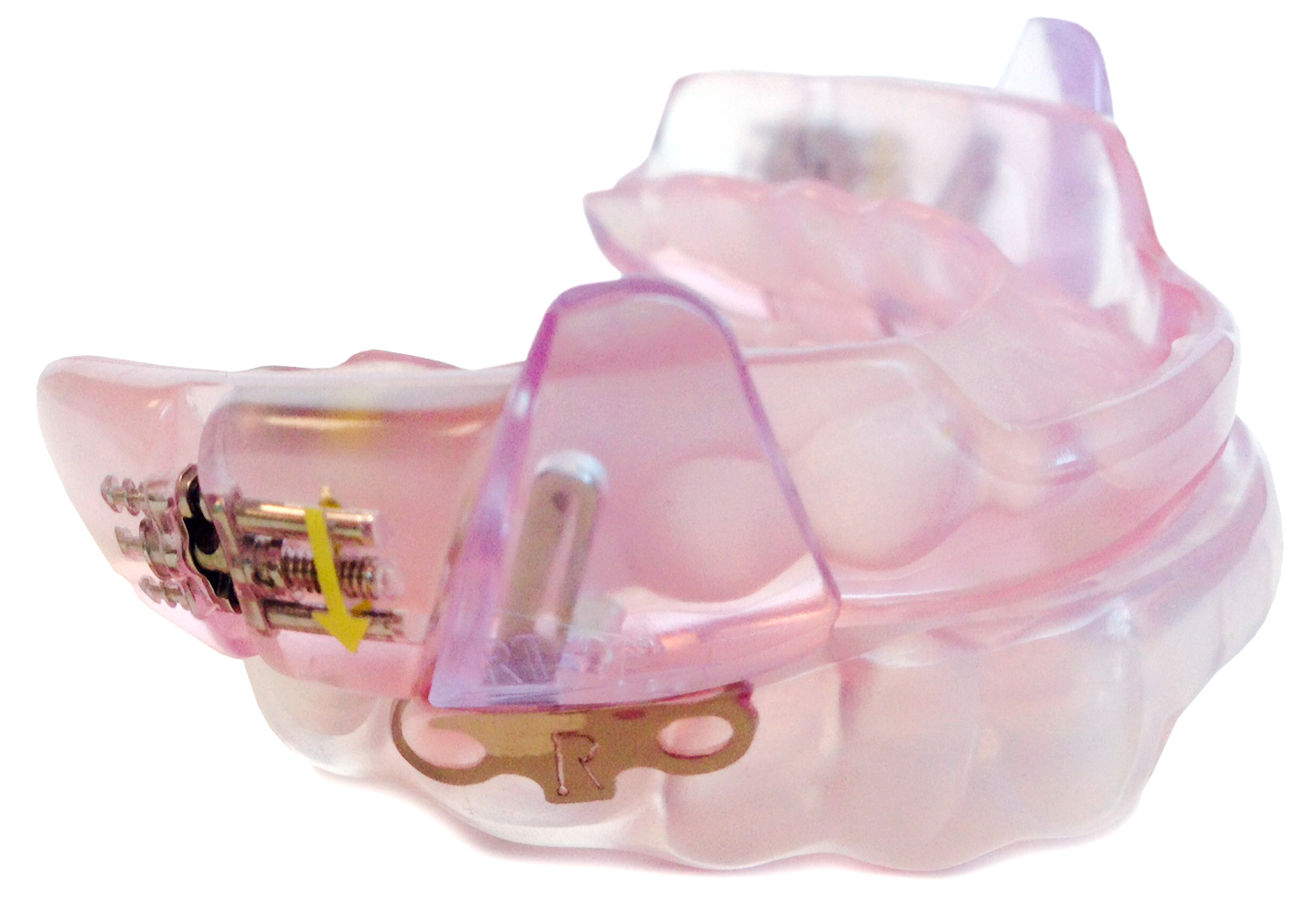 Introducing SomnoDent Herbst Advance and the SomnoDent Fusion DentistryIQ