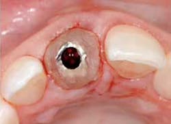 Spearimmedtemp1 Spearimmedtemp1