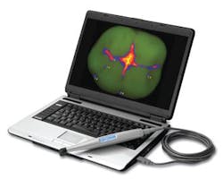 Spectra Caries Detection Aid Spectra Caries Detection Aid