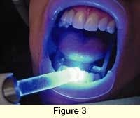 Th 0301dem024fig3 Th 0301dem024fig3