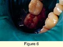 Th 0301dem033f Th 0301dem033f