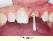 Th 0301dem034b Th 0301dem034b