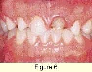 Th 0301dem034f Th 0301dem034f