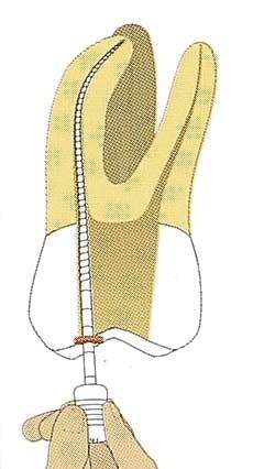 Th 0406dem523 Th 0406dem523