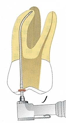 Th 0406dem525 Th 0406dem525