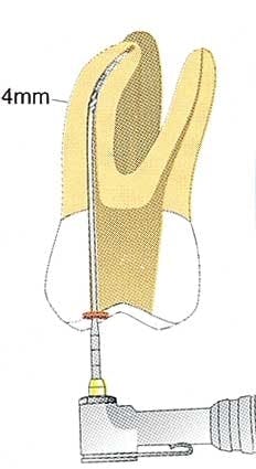 Th 0406dem526 Th 0406dem526